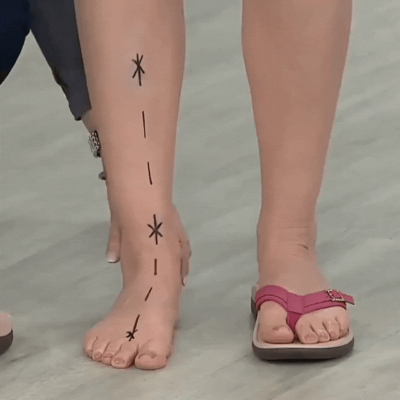 Soleya™ – Orthopaedic Comfort Sandals